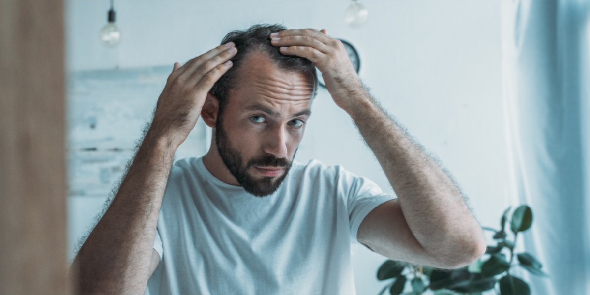 A man checking his scalp for hair loss