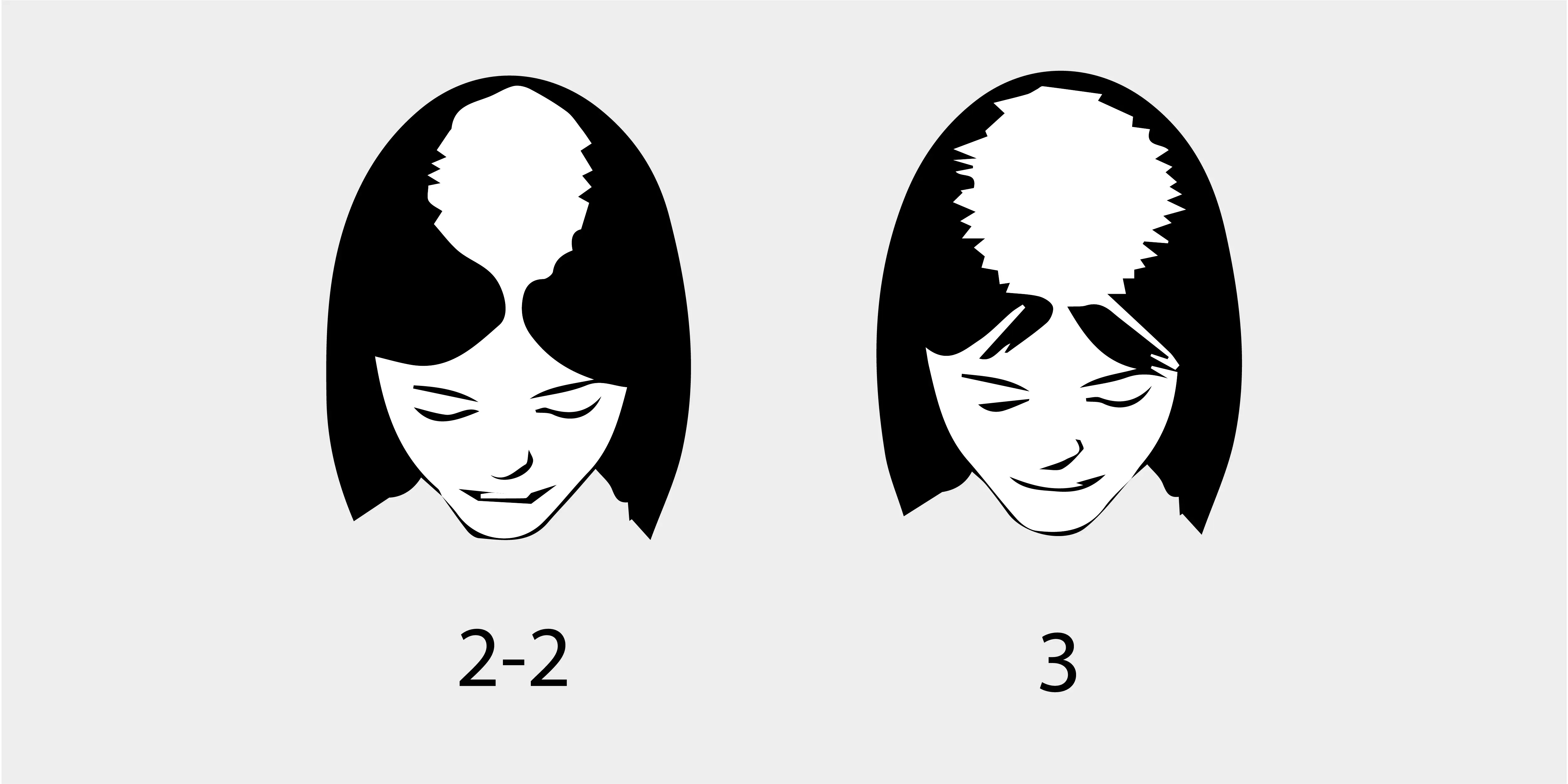 The Ludwig Scale