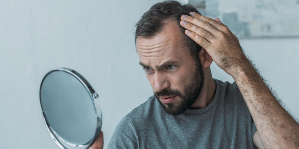 Causes of hair loss, man assessing hair loss