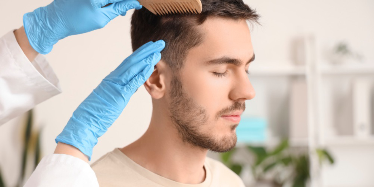 Hair Transplant Side Effects: What You Need to Know
