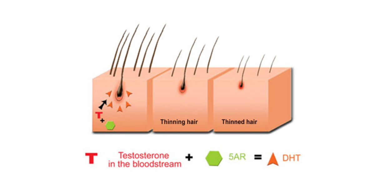 an illustration of how minoxidil and finasteride works