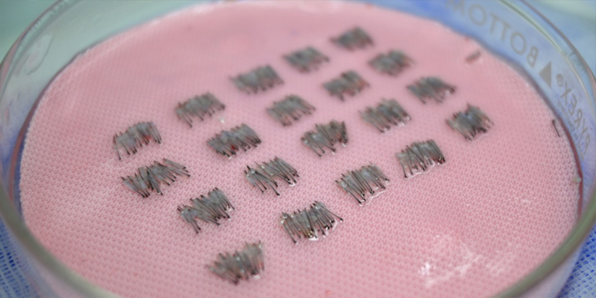 An image of hair grafts being categorized