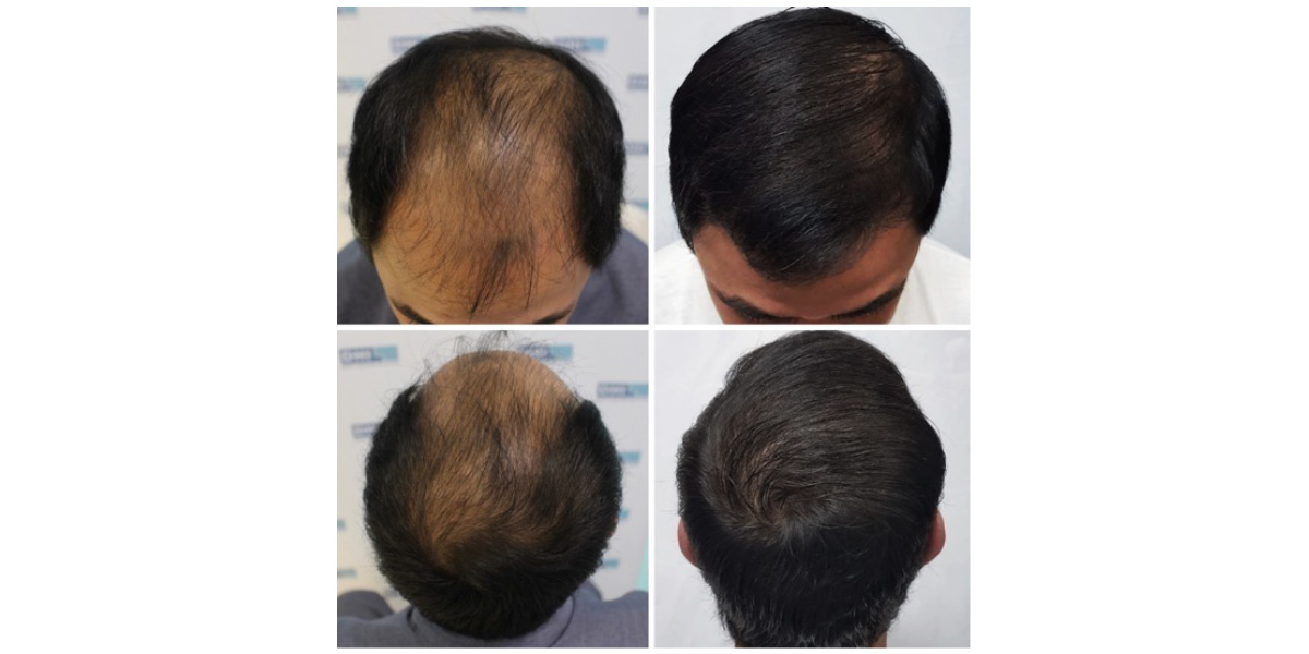 Clinique De Paris - Media & Articles