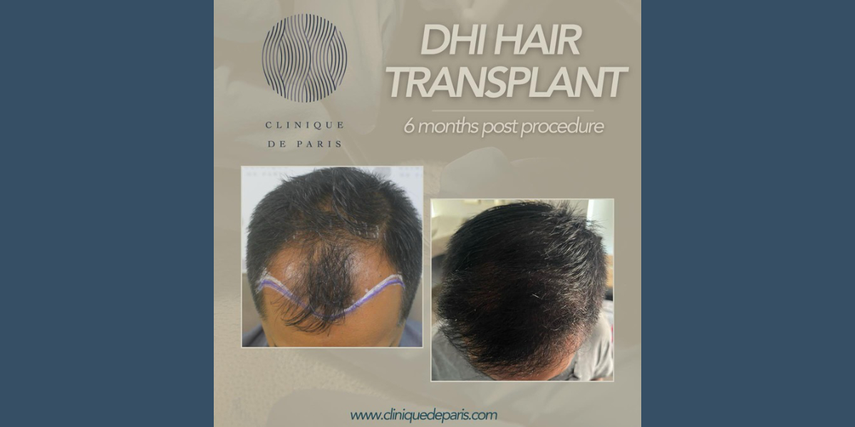 Clinique De Paris - Media & Articles