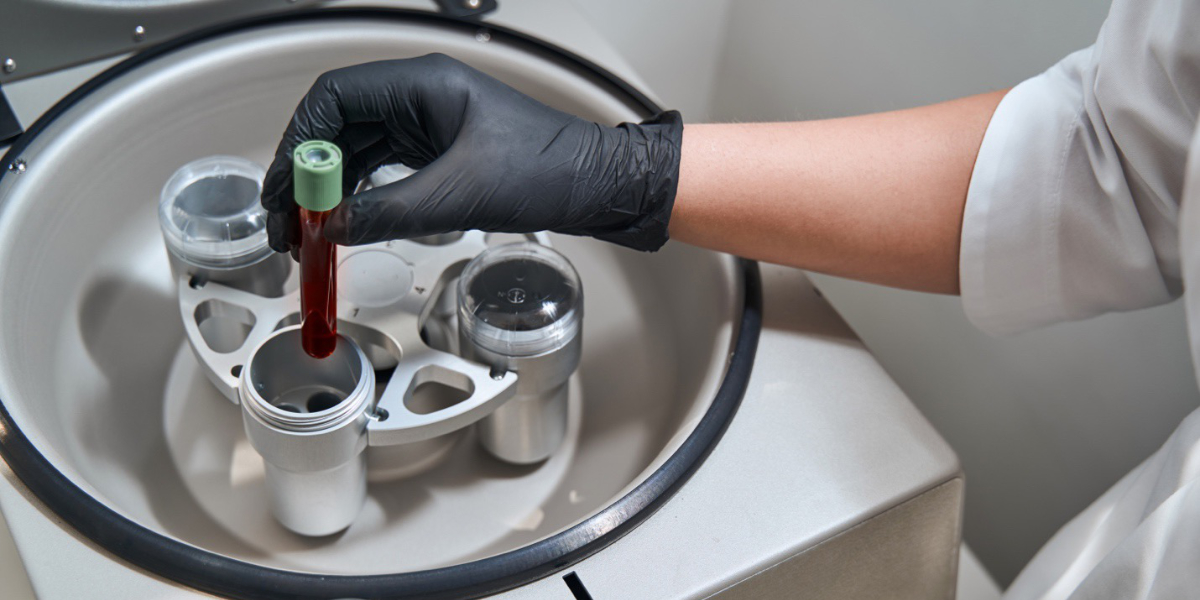 Clinique De Paris - Platelet Rich Plasma for Hair Loss