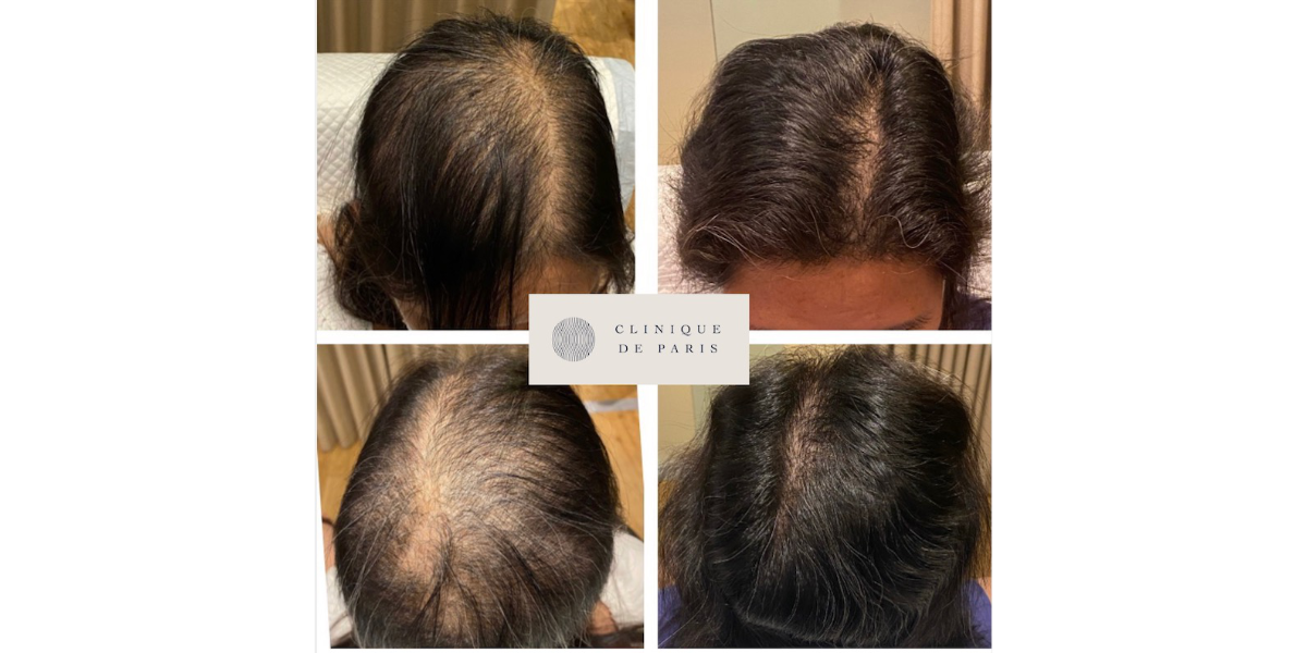 Clinique De Paris - Media & Articles - Tedrick Yau