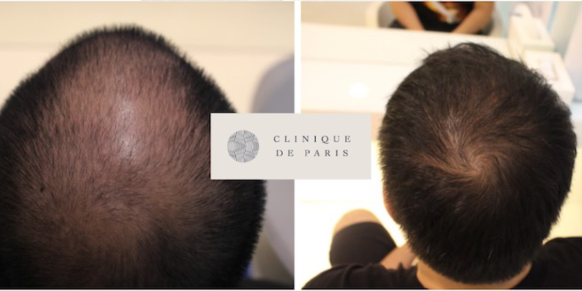 Clinique De Paris - Media & Articles - Tedrick Yau