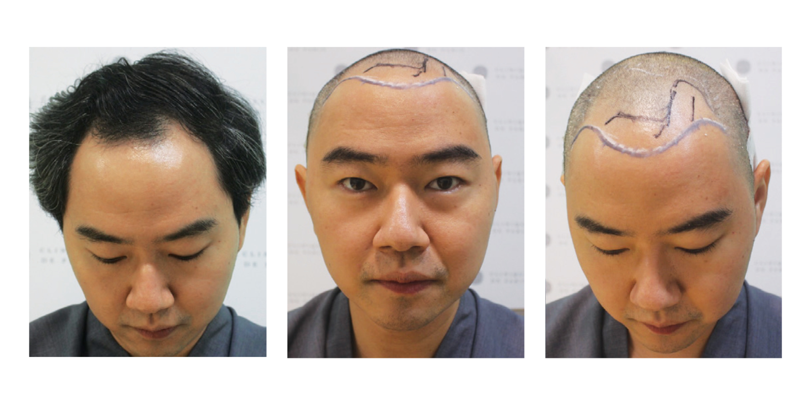 Clinique De Paris - Media & Articles