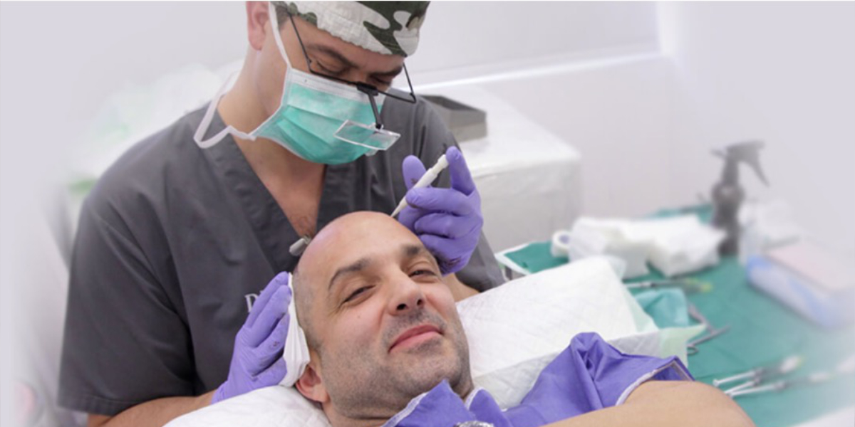 An image of a man getting a hair transplant: