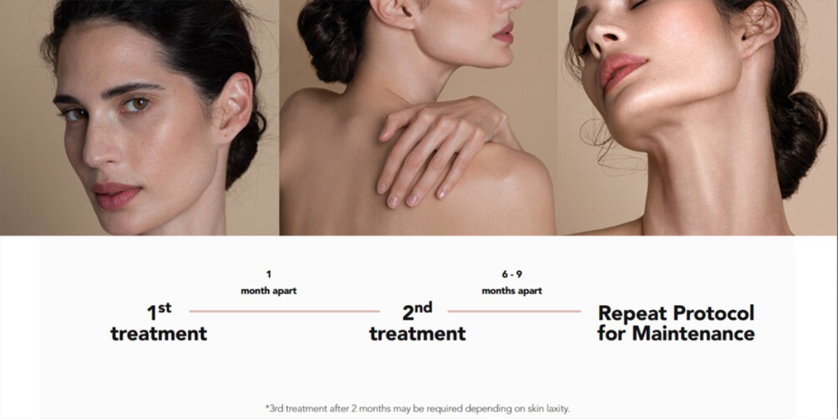 Suggested treatment protocol for Profhilo