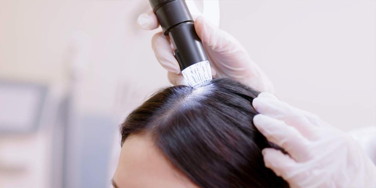 Hair assessment