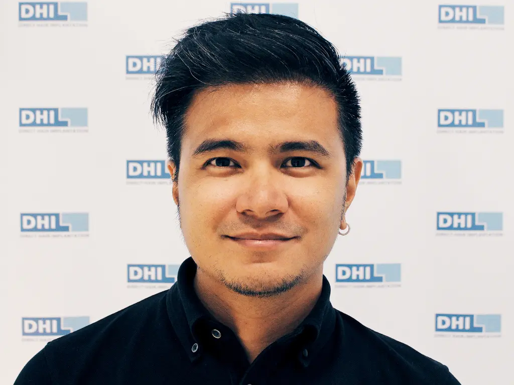 Best hair transplant results have high density and natural result