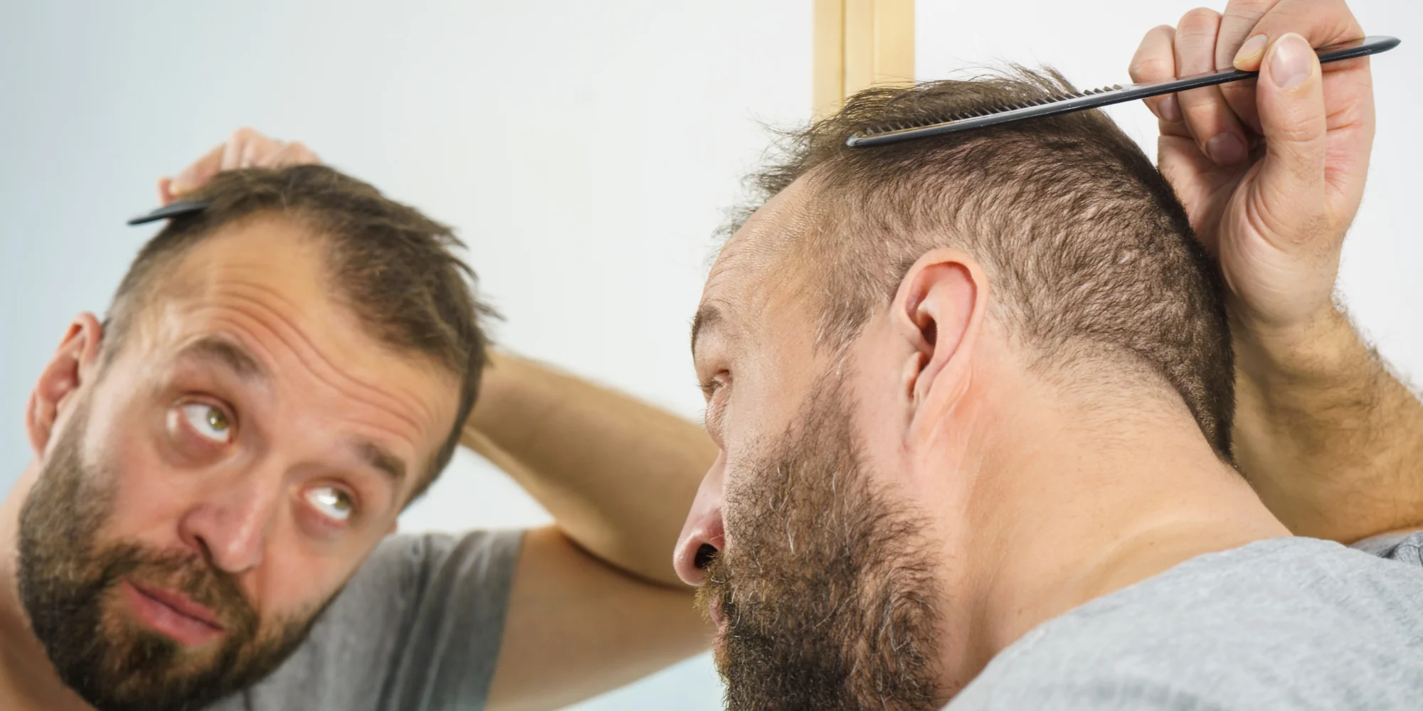 Man looking at his thinning hair in the mirror