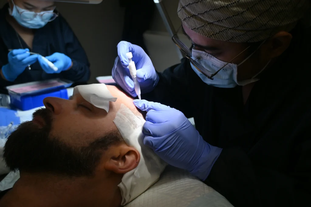 Doctor analyzing and optimizing a hair transplant procedure using a hair growth timeline showing Anagen, Catagen, and Telogen phases