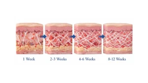 Infographic showing collagen regeneration timeline after Rejuran skin booster treatment
