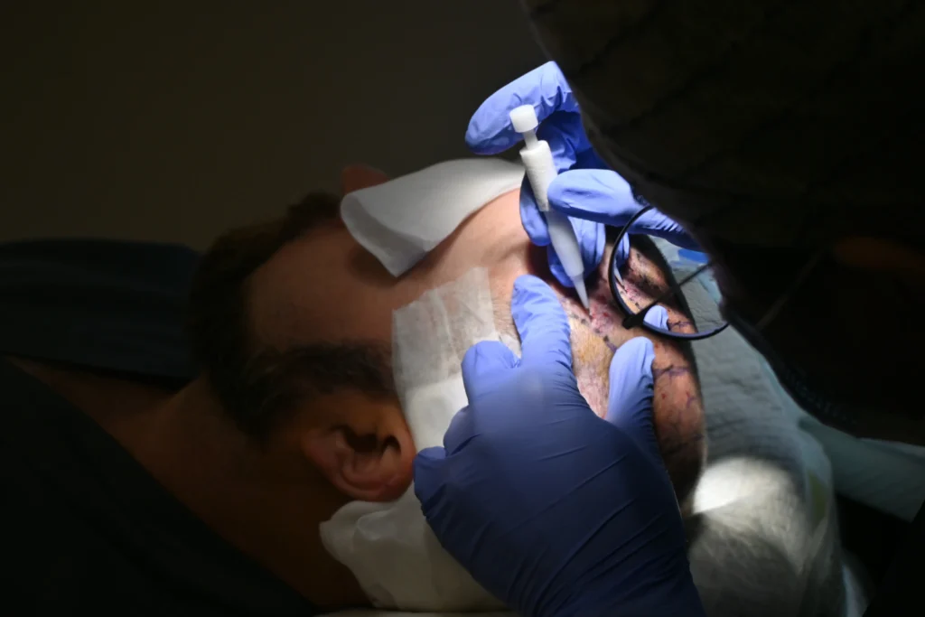 Clinique De Paris scalp treatment procedure