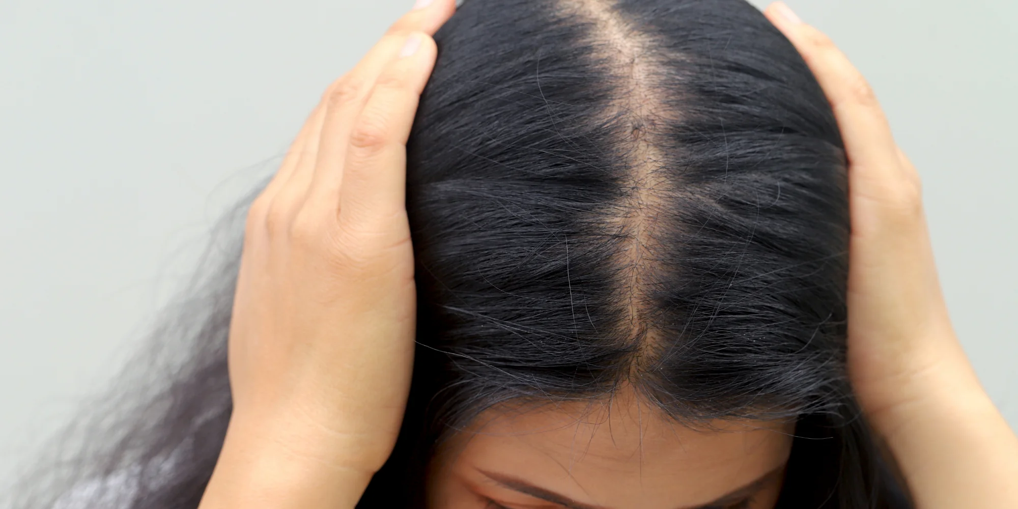 Peptides for Hair Loss: How They Work & Can They Regrow Hair?