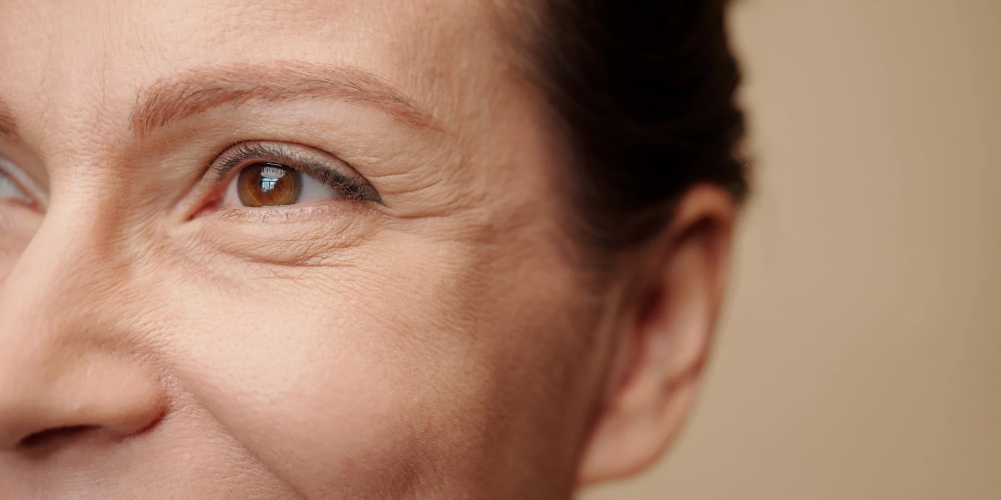 Best Treatment for Fine Lines and Wrinkles That Works!
