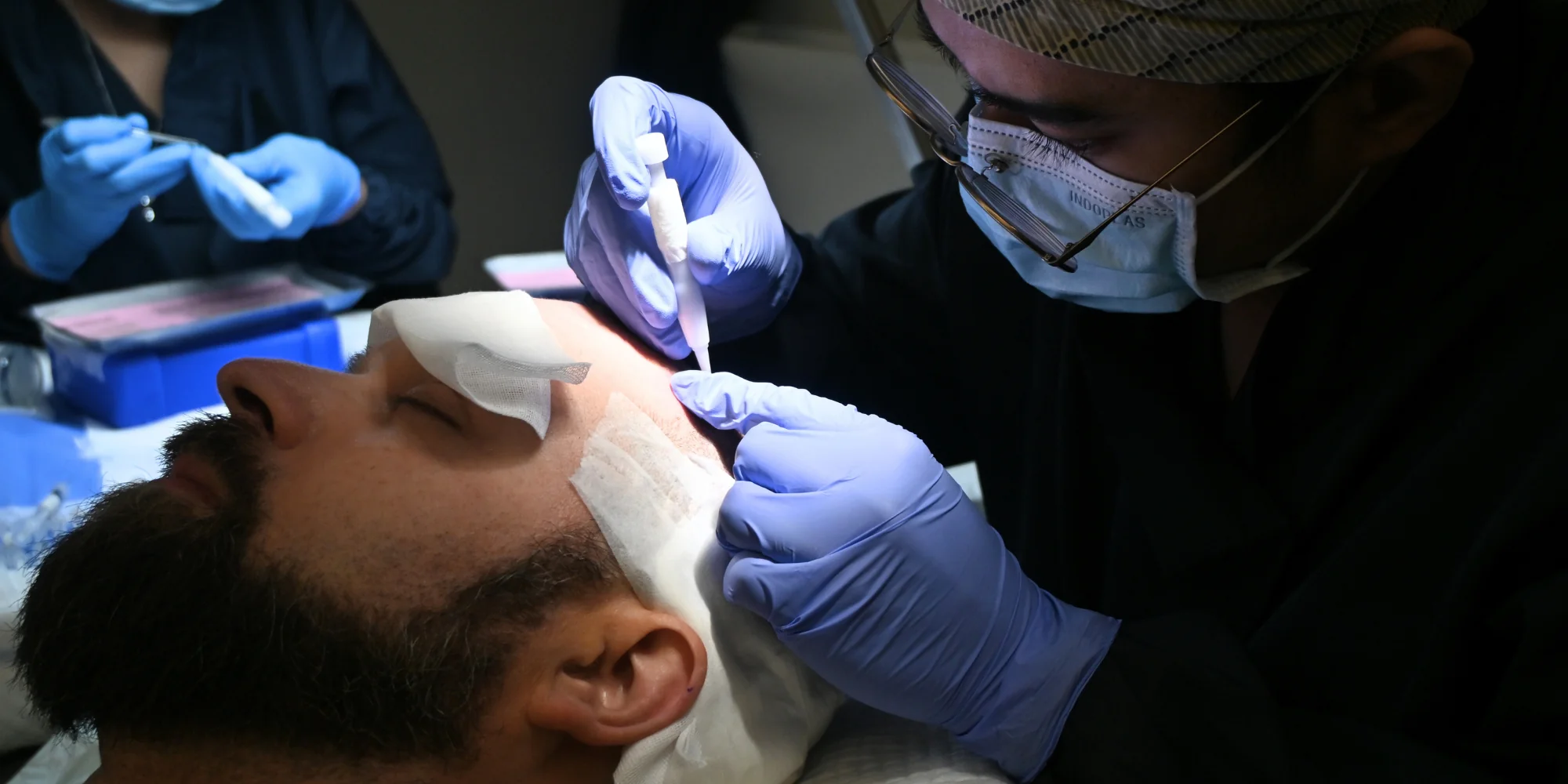 DHI Hair Transplant Philippines: What International Patients Should Know