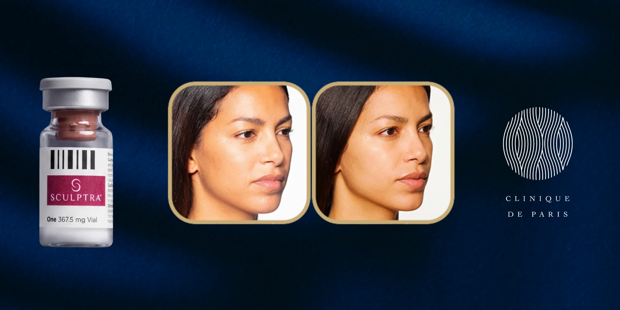 Sculptra Philippines: How It Stimulates Collagen