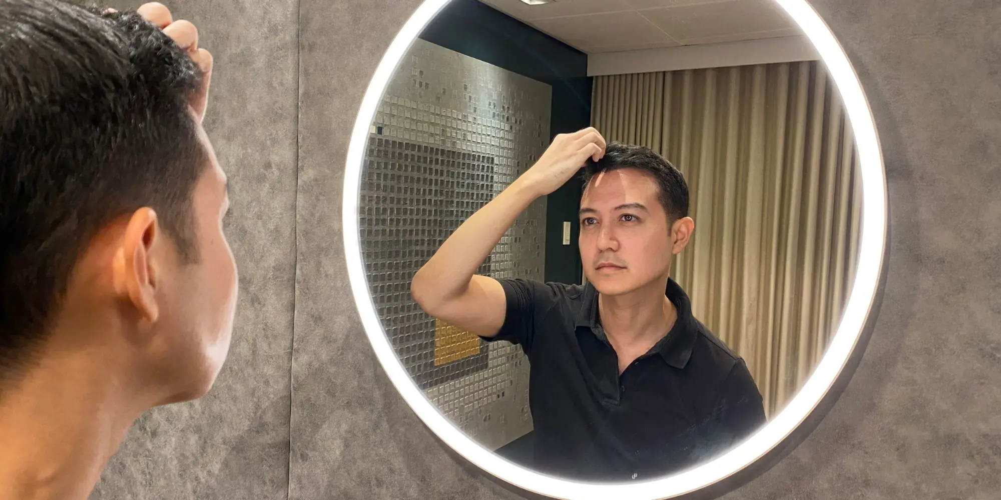 How Is Asian Hair Transplant Different?
