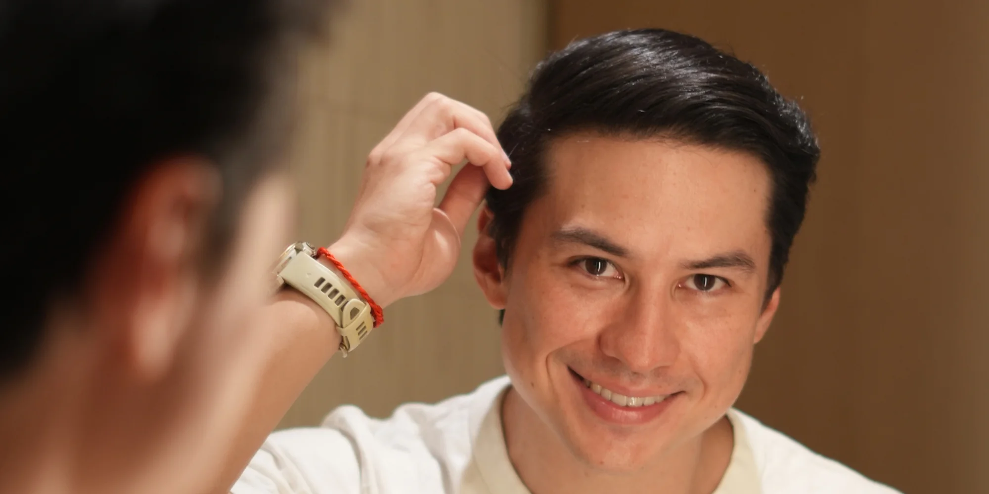 Luch Zanirato’s Story: 1 Year After Hair Transplant